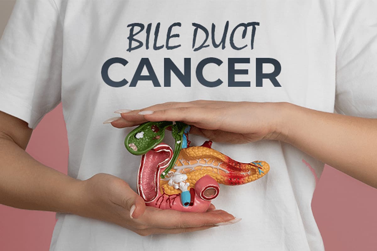 What is bile duct cancer