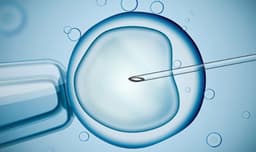 टाइम लैप्स तकनीक: भ्रूण की सेहत पर 5000 डिजीटल तस्वीरों से रखी जाती है नजर, जानिए पूरी प्रोसेस