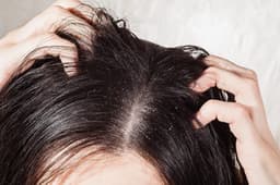 Hair Care Tips: गर्मियों के मौसम में अक्सर खुजली और बालो के टूटने की समस्या से रहते हैं परेशान, तो दूर करने के अपना सकते हैं इन घरेलू उपायों को