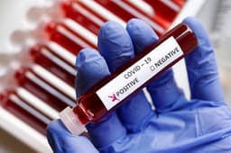 Coronavirus Updates : देश में कोरोनावायरस की रफ्तार हुई तेज, रविवार को 3,824 नए कोविड-19 केस मिले, सरकारें अलर्ट