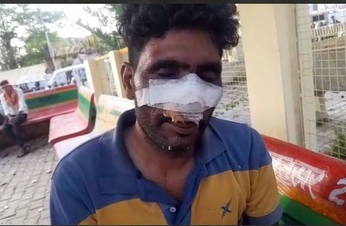 नागौर में घिनौनी हरकत : युवक चिल्लाता रहा वे दांतली से नाक काटते रहे, Video में सुने पीडि़त की जुबानी