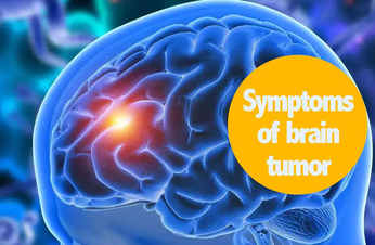 Symptoms of brain tumor : यह संकेत बताते हैं कि आप ब्रेन ट्यूमर से पीड़ित हैं