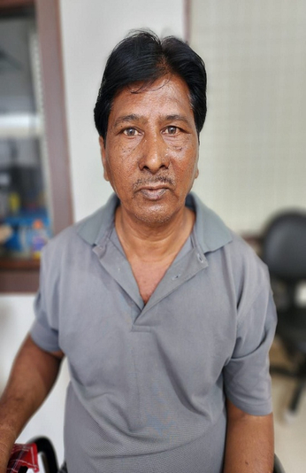 राजकोट : 55 साल के प्रौढ़ की नाक से निकाला 8 सेमी लंबा मस्सा