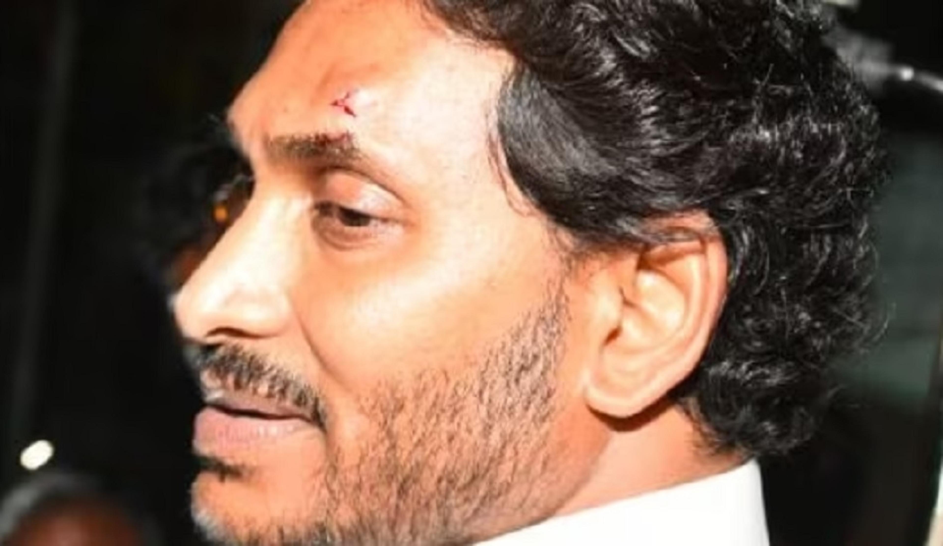 आंध्र प्रदेश : विजयवाड़ा में पथराव के दौरान सीएम जगन मोहन रेड्डी को लगी चोट