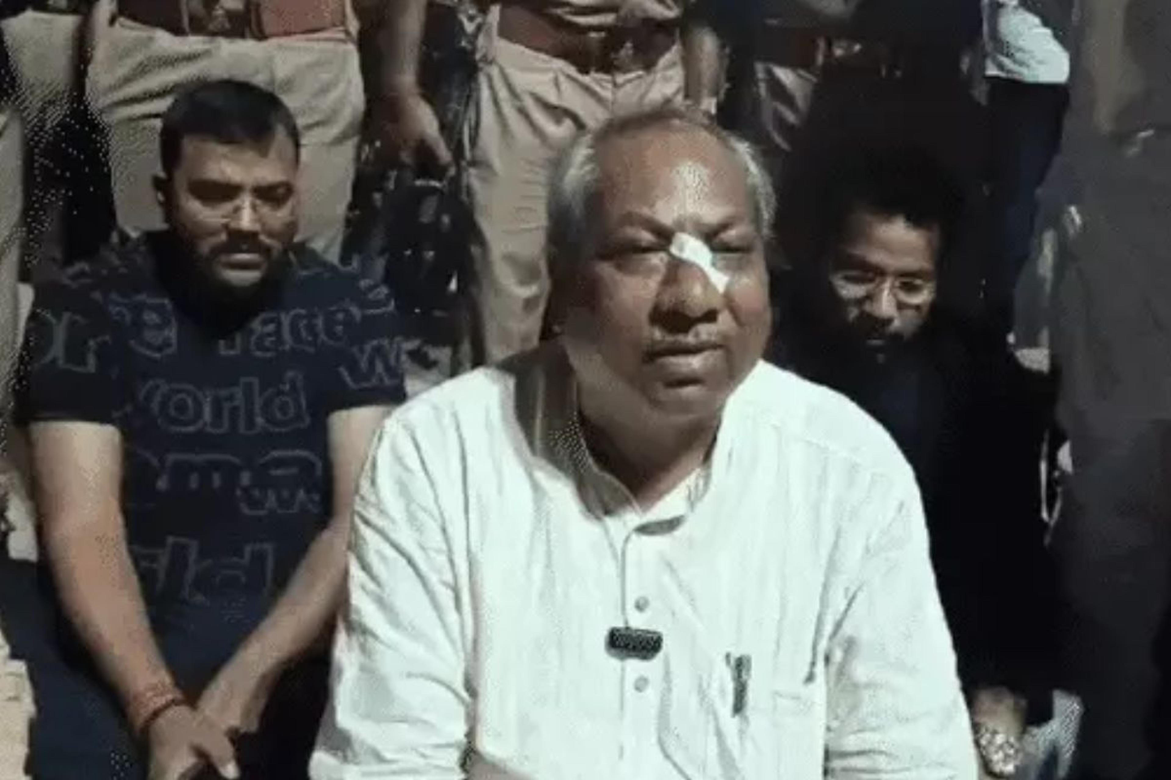 कैबिनेट मंत्री डॉ. संजय निषाद पर हमला, नाक से हुई ब्लीडिंग, यादवों पर लगाया आरोप