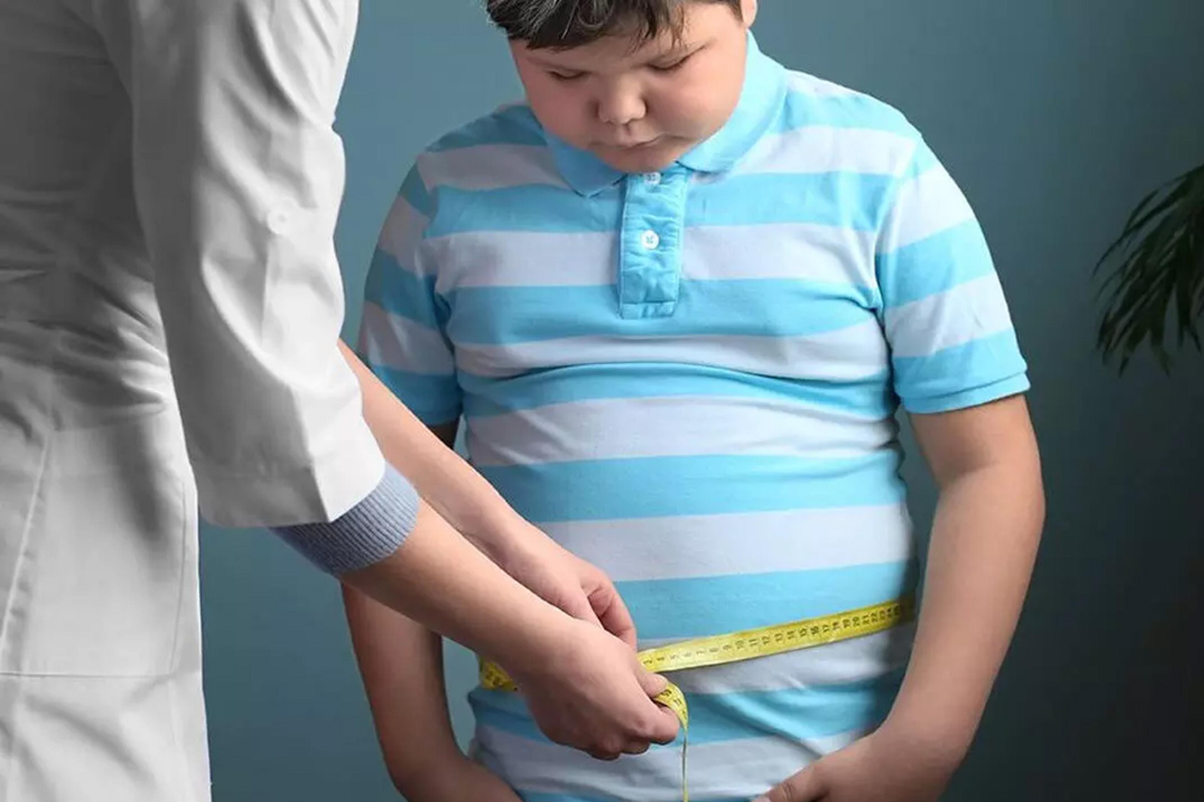 चौंकाने वाला खुलासा: 4 साल की उम्र में मोटापा घटा सकता है बच्चे की आधी उम्र