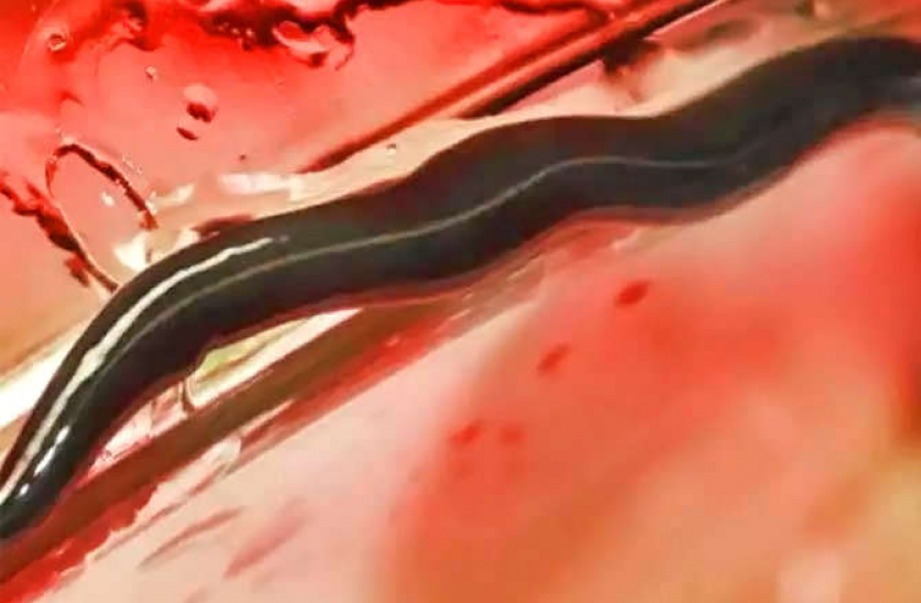 worms in your house अगर आपके भी घर में भी दिखाई दे ऐसा कीड़ा तो हो जाएं सावधान! इसे छूने भर से हो सकती है इंसान की मौत!