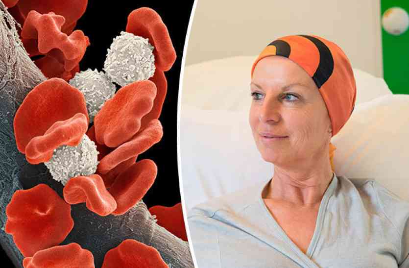 Vitamin-C reduces the risk of blood cancer ब्लड कैंसर के खतरे को कम करती है विटामिन-सी
