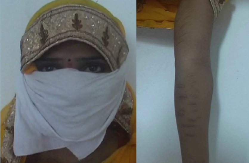 Love Jihad Allegation लव जेहाद!, पहले झूठ बोलकर की शादी, फिर प्रताड़ना की हद पार कर दी, ब्लेड से काटने लगा शरीर