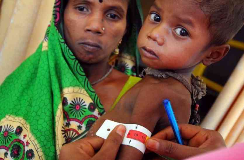 Malnutrition आशा कर रहीं कुपोषित बच्चों की पहचान : न्यूट्रिशन सेन्टर दूर करेगा कुपोषण