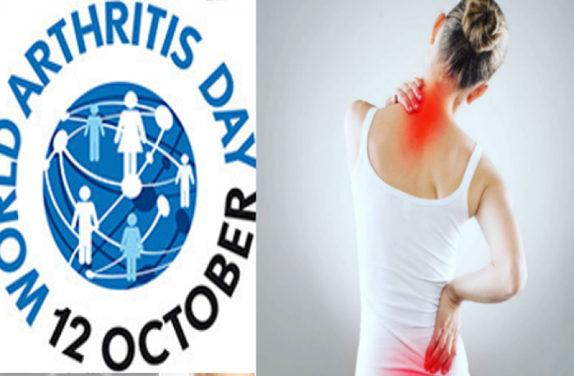 world-arthritis-day जानें आर्थराइटिस के निदान के लिए ये खास बातें, करें ये व्यायाम और परहेज