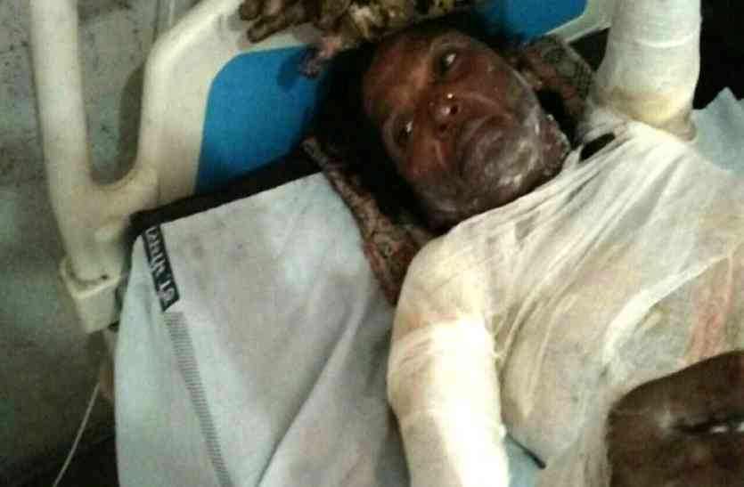 self immolation बेटे ने किया अंतरजातीय विवाह तो सामाजिक प्रताडऩा झेल रही मां ने उठाया खौफनाक कदम