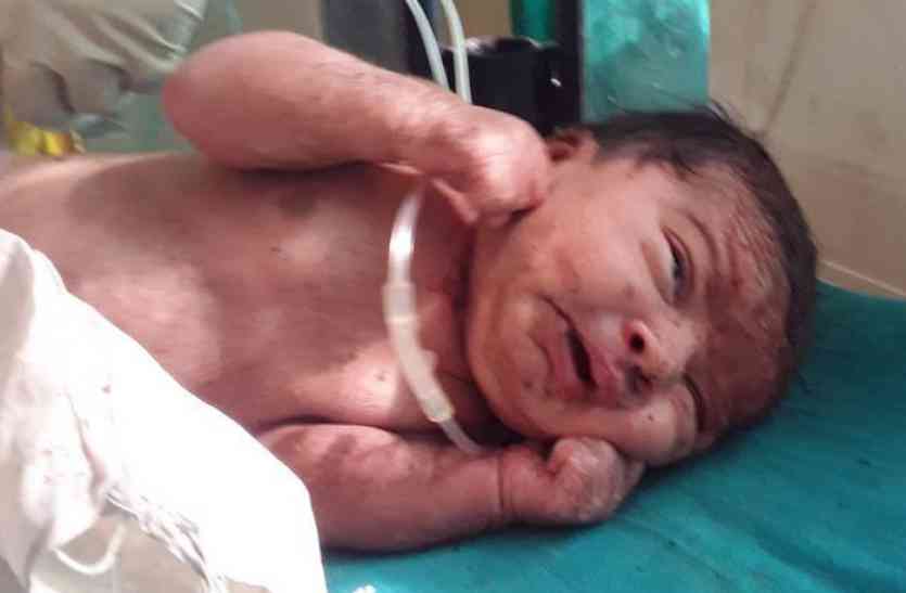 newborn baby चूरू शर्मसार: जन्मते ही बेटी का गला घोंटने का प्रयास, नहीं मरी तो कट्टे में लपेट कर मंदिर के पास फेंका