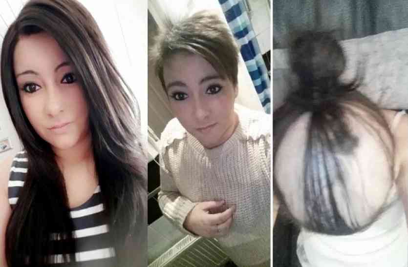 Breakup, girl became bald, बाल झड़गा, ब्रेकअप ब्वॉयफ्रेंड से ब्रेकअप के बाद इस लड़की के साथ हुआ कुछ ऐसा कि डॉक्टर भी रह गए हैरान