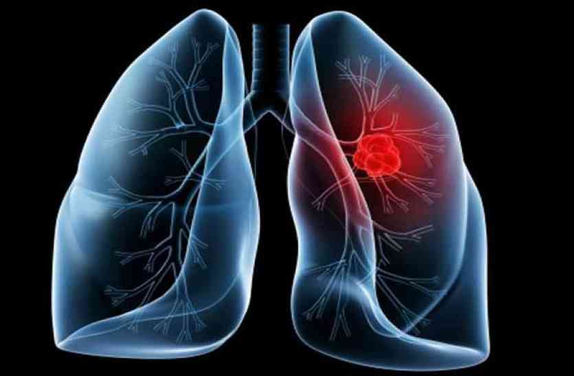 Lung Disease In Hindi - Asthma Lung Disease