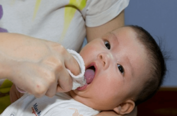 The tongue of the children is also related to the problem of speaking बच्चों की जुड़ी हुई जीभ से भी होती है बोलने में समस्या