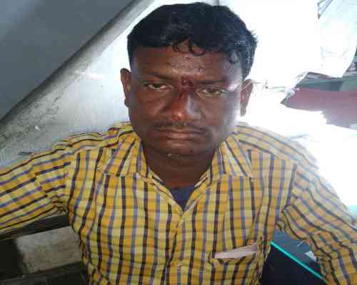 Injured Auto driver