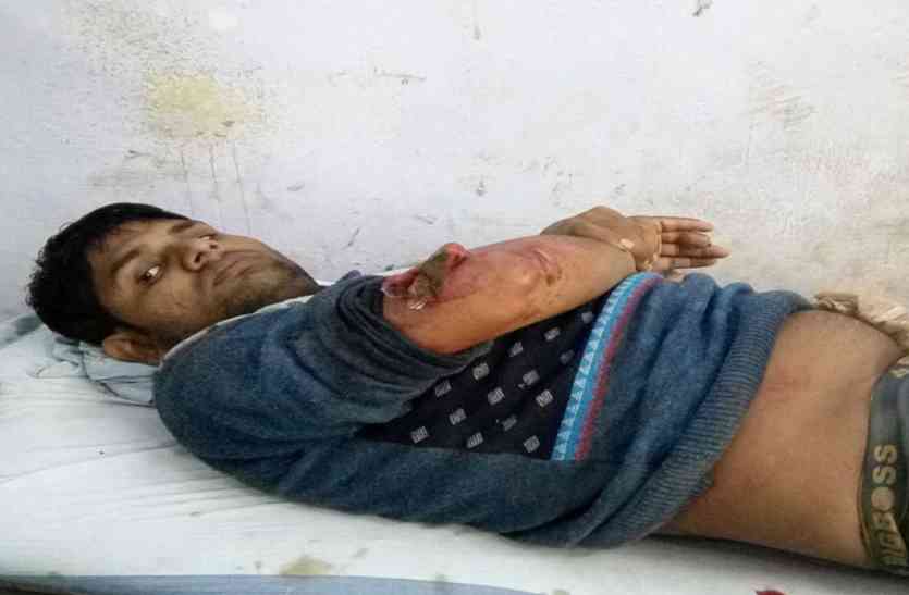 patrika ब्लॉस्टिंग में सुपरवाइजर गंभीर घायल