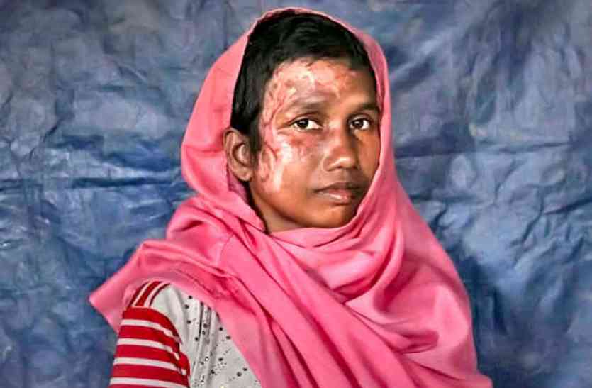 rohingya दर्द की तस्वीरें: बहुत ज़ालिम है ये दुनिया, मां के सामने ही 25 दिन के बेटे को दी ऐसी मौत