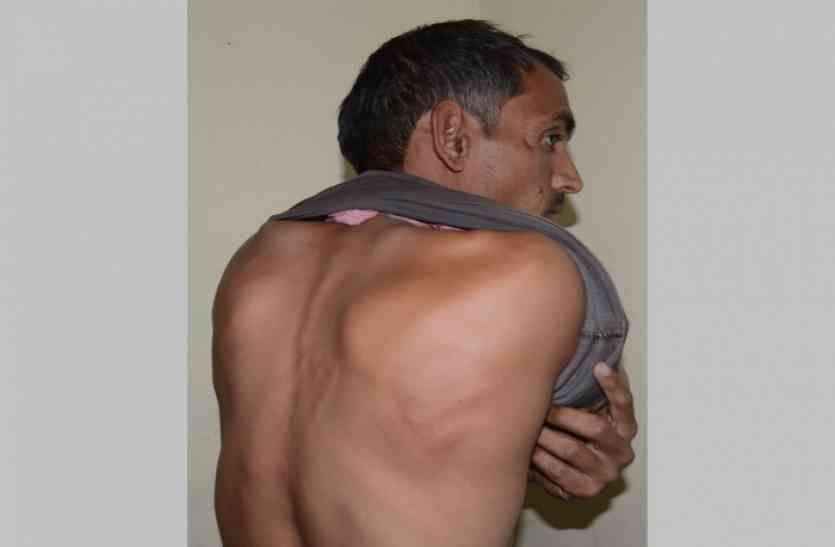 brutality of police in jodhpur पत्रिका खबर का असर : थाने में पुलिस की दंबगई मामले में होगी जांच, पीडि़त युवक को दिखी न्याय की आस