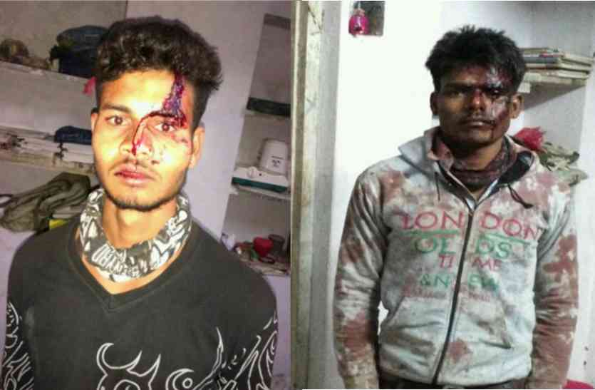 attack on family video: इन बेटाेें को दीजिए शाबाशी.. लुटेरों से किया बहादुरी से मुकाबला, लहूलुहान हुए फिर भी डटे रहे, आखिर दो लुटेरेे पकड़े गए