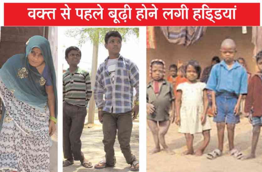 Poisonous smoke खुलासा: समय से पहले बूढ़े हो रहे कोटा के लोग, विकृत हो रहे नाजुक अंग और थम रहा बच्चों का दिमागी विकास