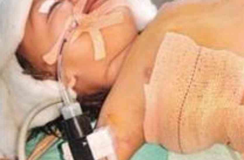 Lucknow Health News फेफड़े तक नहीं पहुंच रही थी ऑक्सीजन, डॉक्टरों ने ऑपरेशन कर बचाई बच्चे की जान