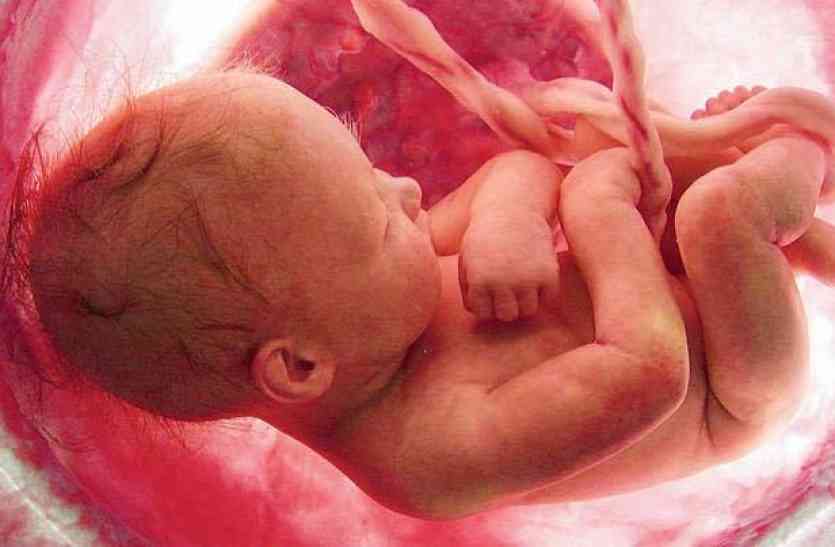 foeticide यहां हर साल सबसे ज्यादा मासूम नहीं देख पाते दुनिया, इस वजह से जन्म लेते ही हो जाती है मौत