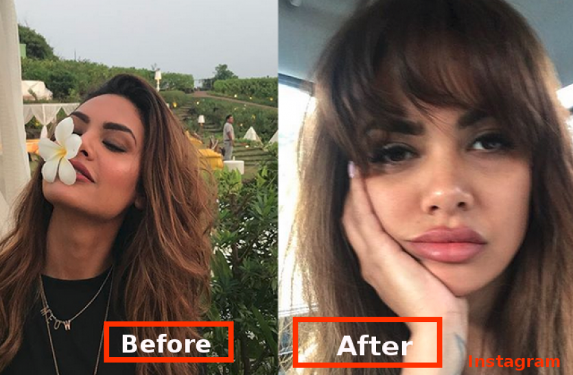 Esha Gupta Lip Size Seems Changed Is It Lip Surgery - ईशा गुप्ता के