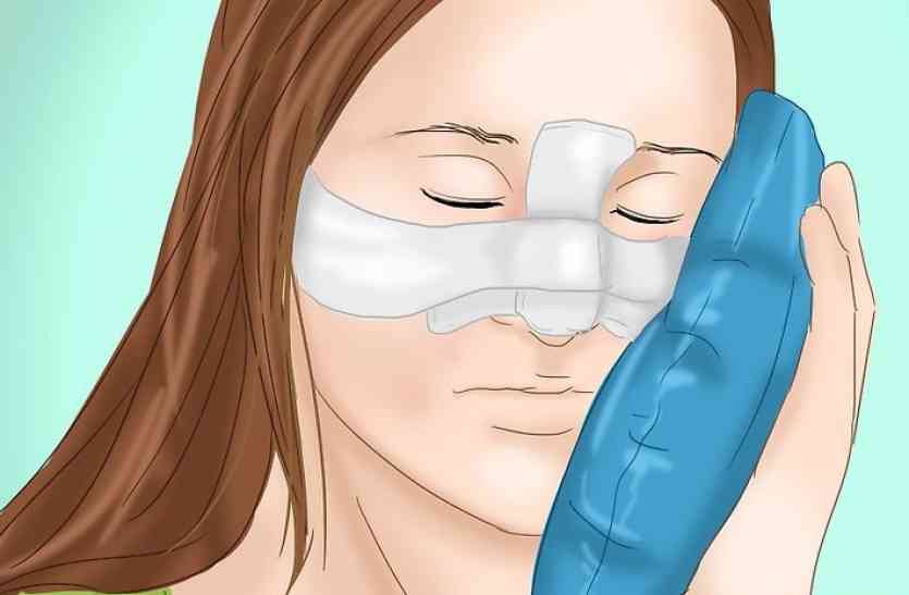 nose photo: मैडम हीरोइन बनने चली थीं, सर्जरी करा-करा कर चेहरे को बना दिया कबाड़ा