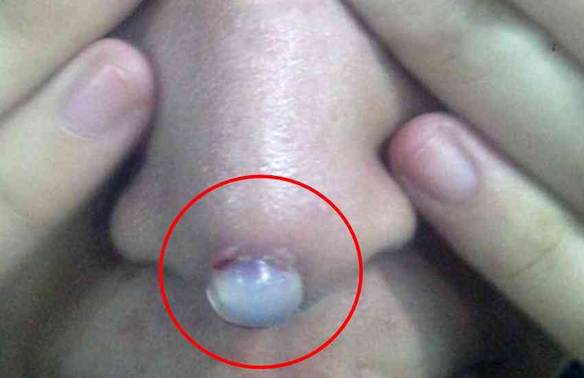nose