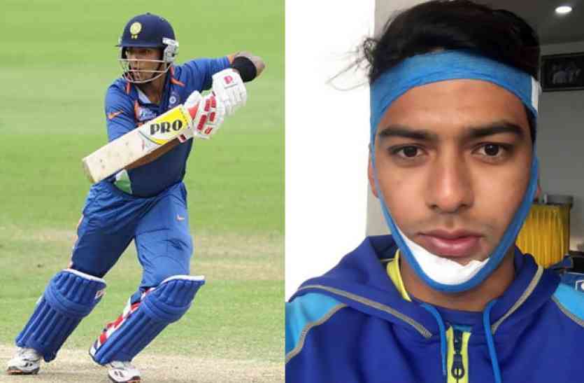 unmukt chand इस भारतीय क्रिकेटर ने दिलाई कुंबले की याद, टूटे जबड़े के साथ की बल्लेबाजी और ठोक दिया शतक