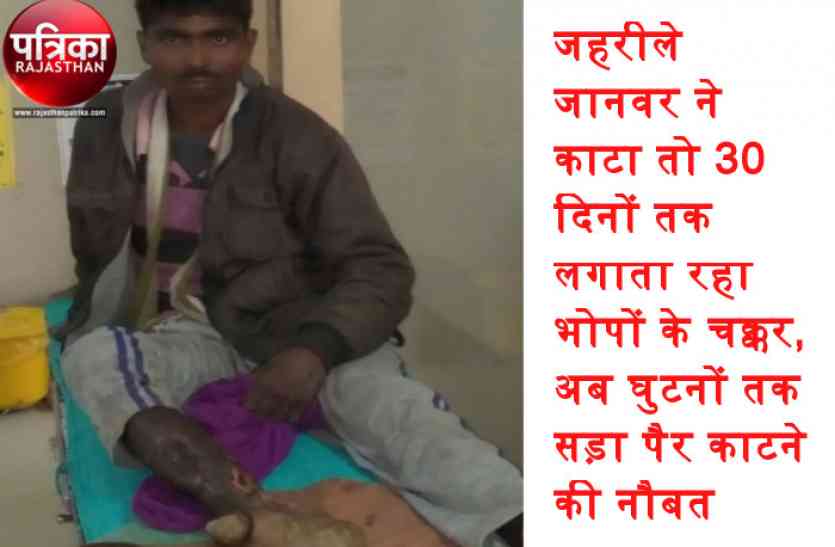 banswara news Video : बांसवाड़ा : जहरीले जानवर ने काटा तो 30 दिनों तक लगाता रहा भोपों के चक्कर, अब घुटनों तक सड़ा पैर काटने की नौबत