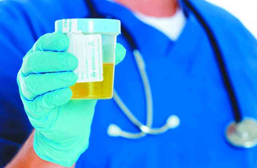urine test यूरिन करते वक्त दर्द के साथ खून का थक्का आए तो हो जाएं सतर्क