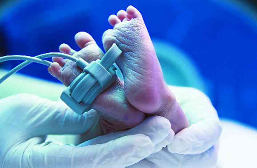 blue baby ब्लू बेबी लक्षणों की शीघ्र पहचान जरूरी