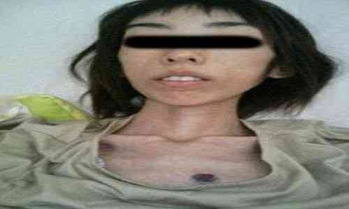 violating probation in domestic abuse case,grandfather,domestic abuse,hospitalised,forbidden,Abusive,weighing,domestic abuse stories,social media post,japanese woman,