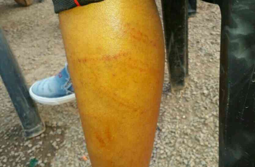 school teacher ruthlessly beaten the students know why कक्षा चौथी की छात्रा को शिक्षक ने बेरहमी से पीटा, जानिए क्यों