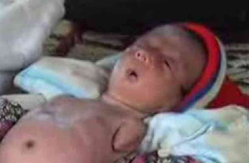 Child Born without hands OMG ! कोटा में जन्मी ऐसी बालिका जिसे देख परिजनों की आंखें फटी की फटी रह गई...
