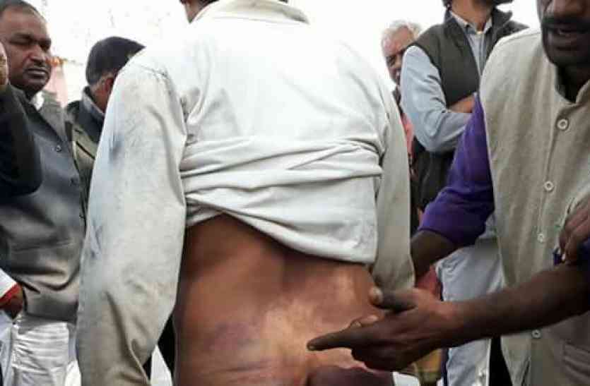 Beating of Driver नायब तहसीलदार ने ड्राईवर को लहूलुहान करवा जख्मों पर रगड़वाया नमक और मिर्च, देखने वालों की कांप गई रूह