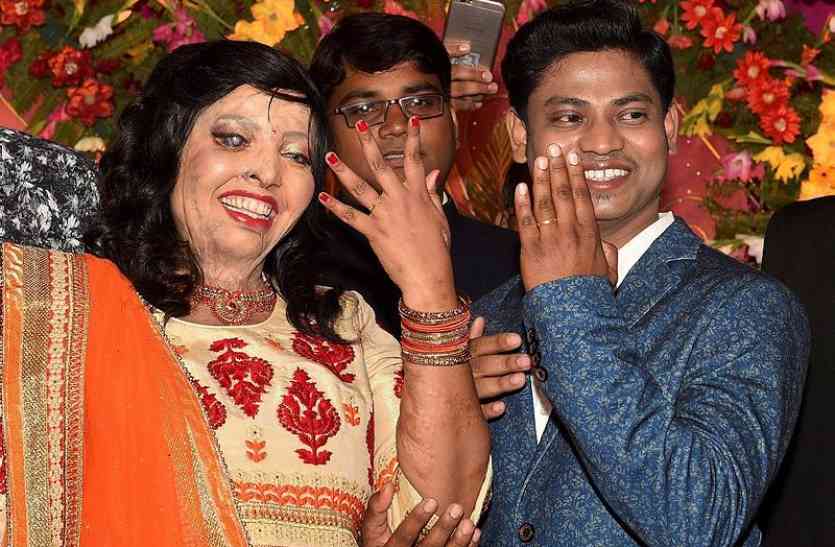 acid attack कई साल पहले शुरु हुई थी इस साल की सबसे बड़ी लव स्टोरी, एसिड विक्टिम को मिला सपनों का राजकुमार