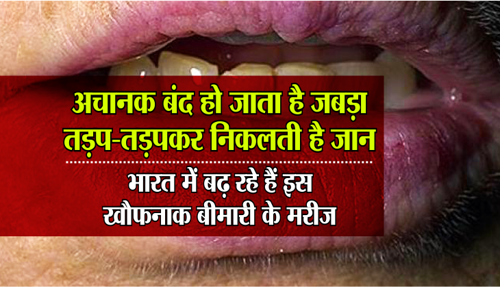 oral-cancer-symptoms-causes-treatments-in-hindi