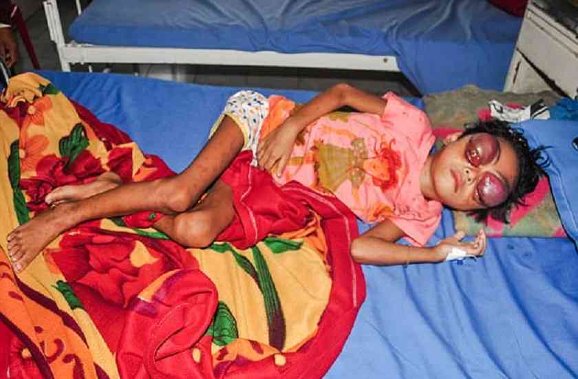 tripura,cancer,pictures,painkillers,chemotherapy,deteriorated,Bleeding,