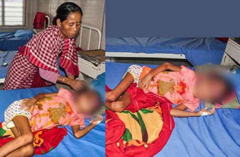 tripura,cancer,pictures,painkillers,chemotherapy,deteriorated,Bleeding, 6 हफ्ते पहले बिलकुल ठीक थी ये बच्ची, फिर क्या हुआ जो आंखों से बहने लगा खून