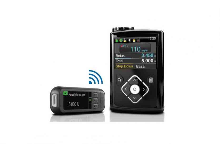 Medtronic Smart CGM System ब्लड में ग्लूकोज लेवल कम होगा या ज्यादा, अब 1 घंटे पहले ही चल जाएगा पता