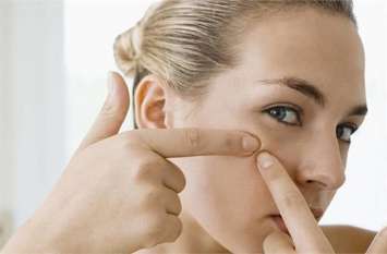 pimples pimples
