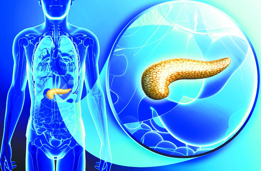 Sugar Level Can Get Affected In Pancreas Cancer - पेंक्रियाज के कैंसर में  भी बिगड़ सकता है शुगर लेवल | Patrika News