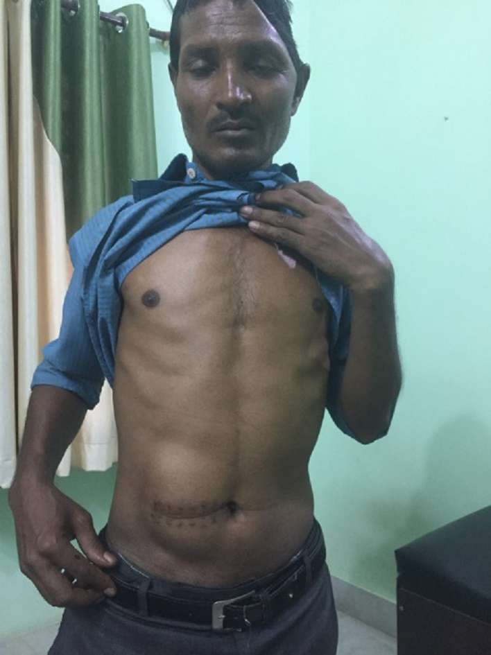 amazing operation done by mumbai doctors