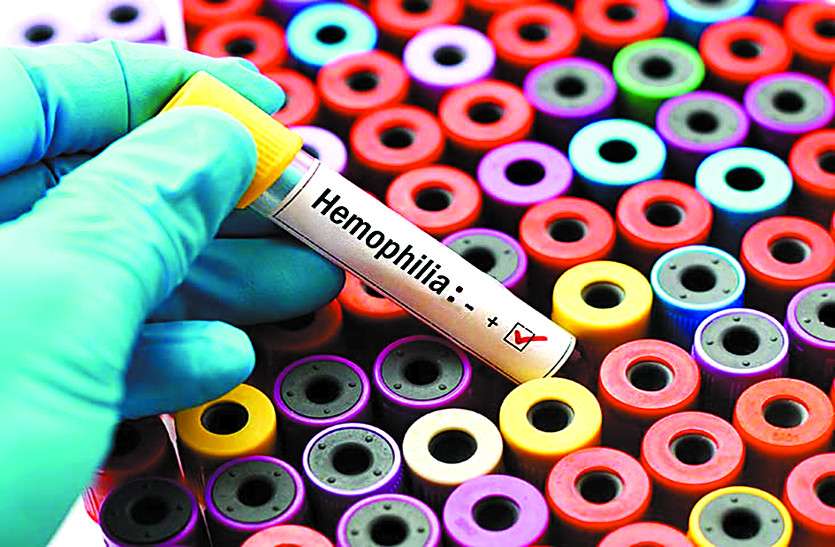 hemophilia patients 85 प्रतिशत हीमोफीलिया मरीजों की पहचान के बावजूद भी नहीं कोई उपचार
