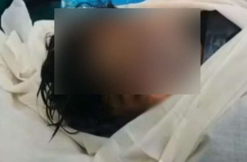 crime भूख से परेशान होकर बड़ा भाई बना हैवान, छोटे भाई की नाक काट कर खाई