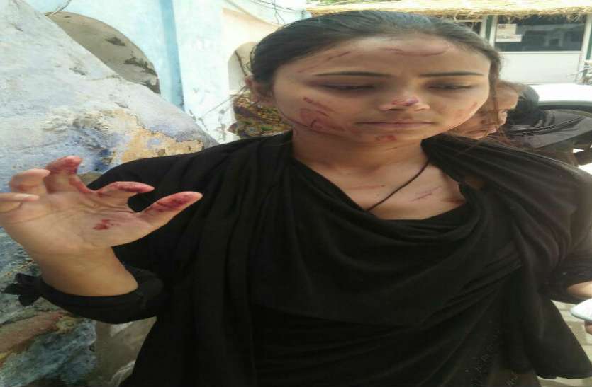 nazia बहादुर बेटी पर भारी पड़े दबंग, वीरता पुरस्कार से सम्मानित नाजिया पर हमला